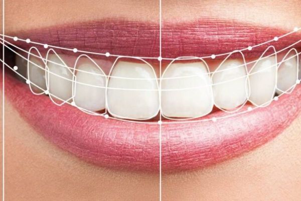 Estética dental